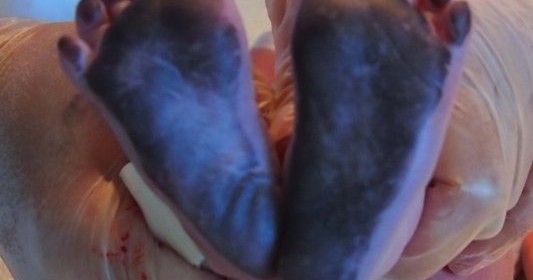 Allison’s Birth Story: Part Three